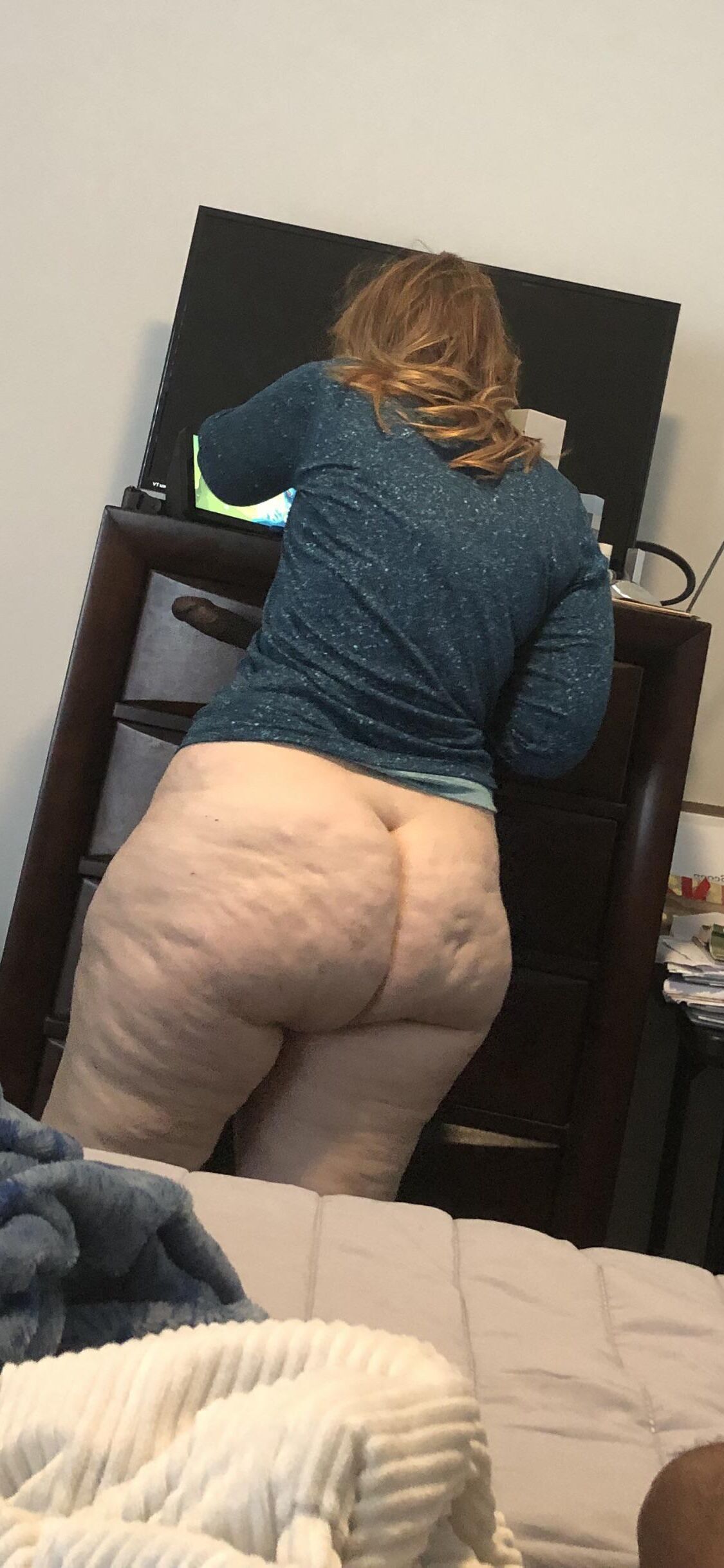 Cellulite Gilfpawg