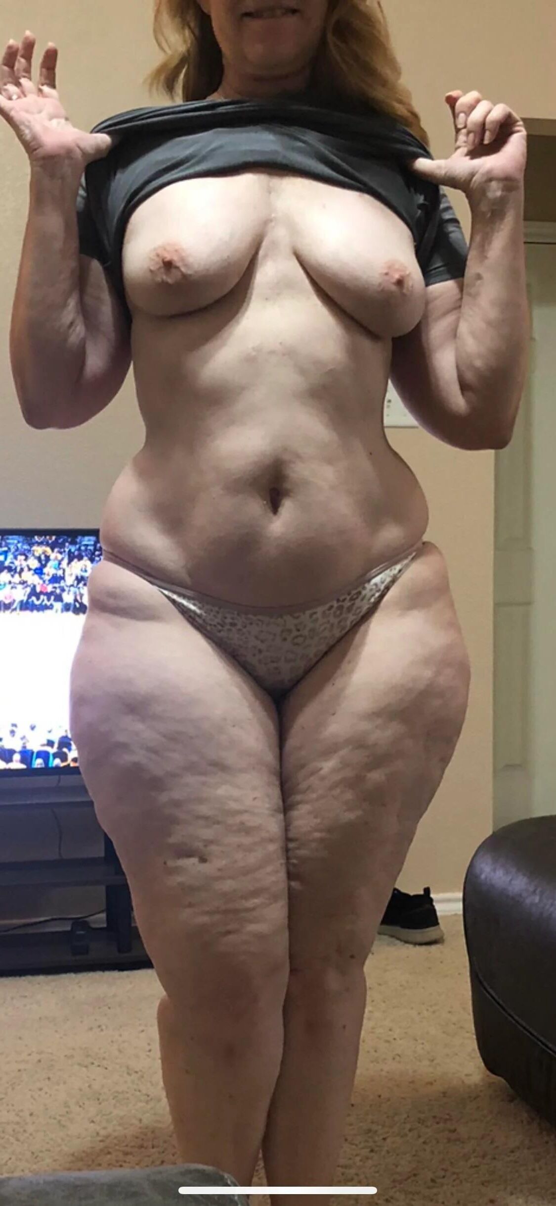 Gilfpawg Cellulite 