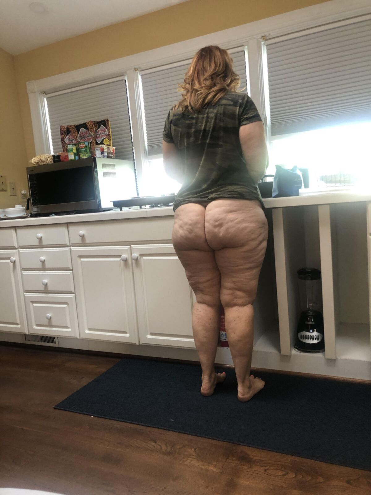 Cellulite Gilfpawg