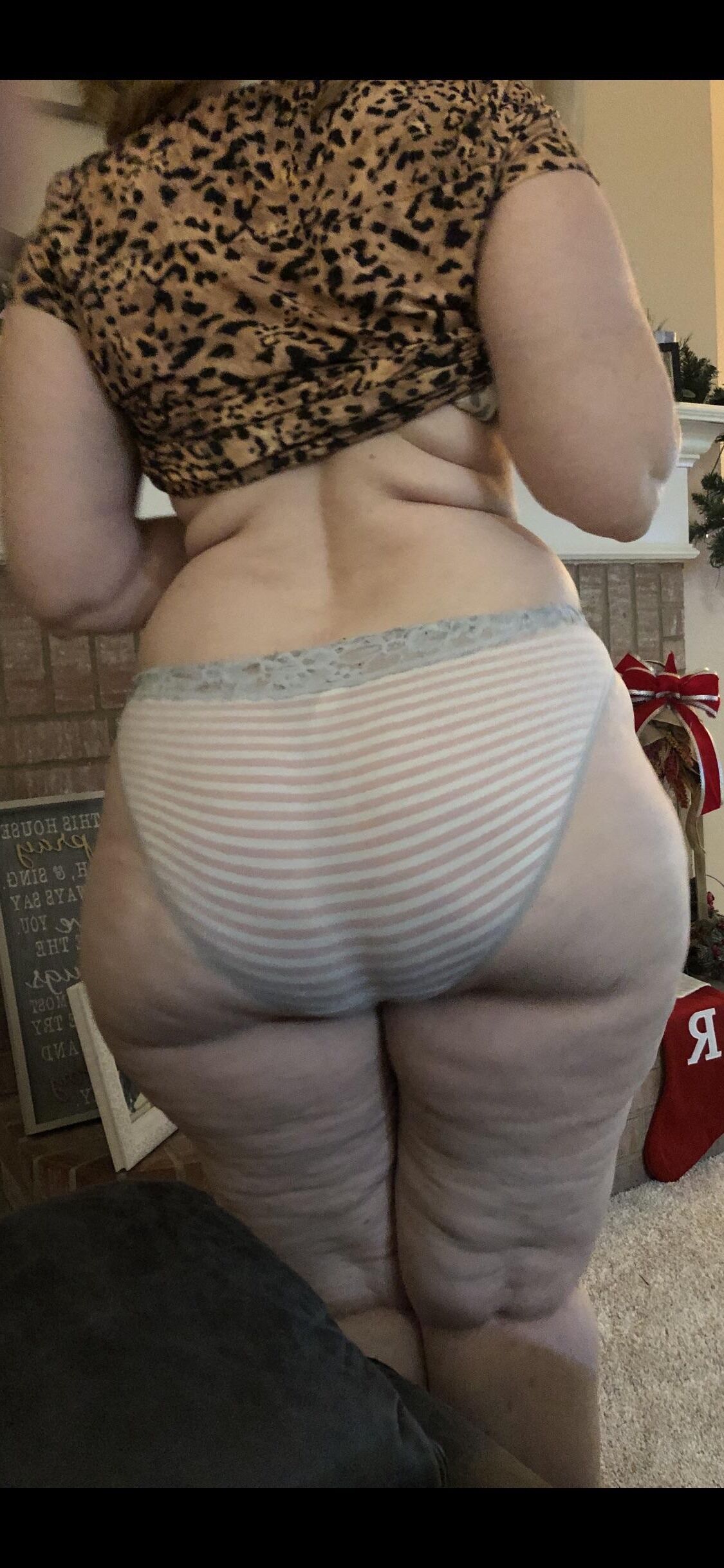 Gilfpawg Cellulite 