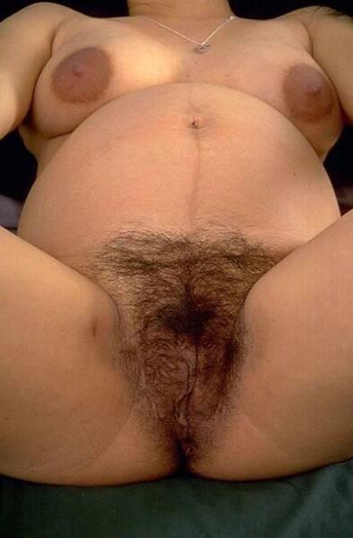 Hairy pregnancy