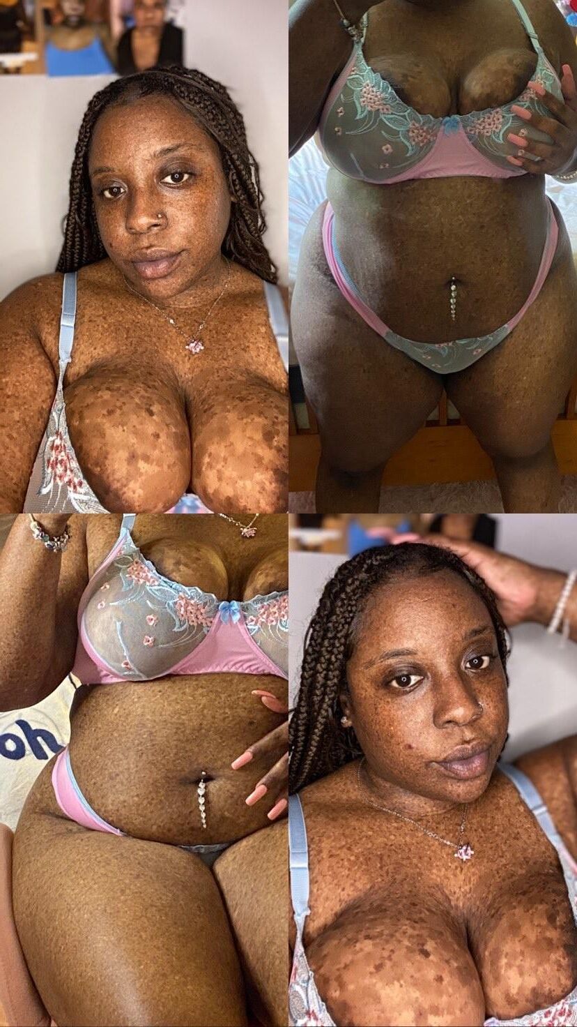 Freckles Huge Areola Ebony Big Booty Milf Rose