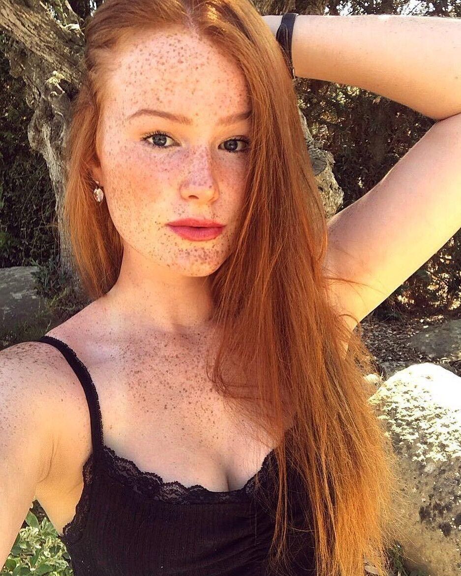 Freckled redheads