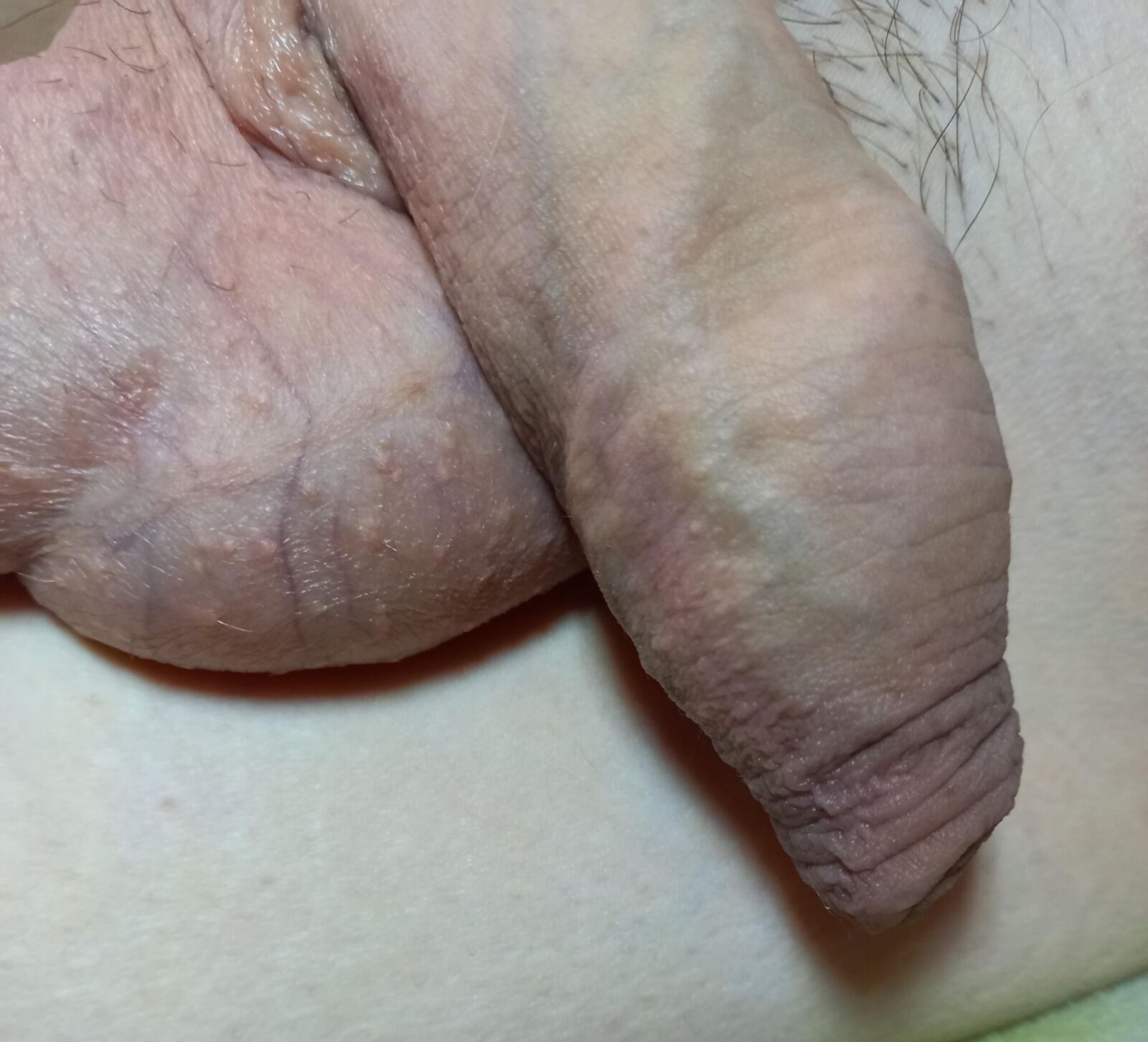 Small penis 2