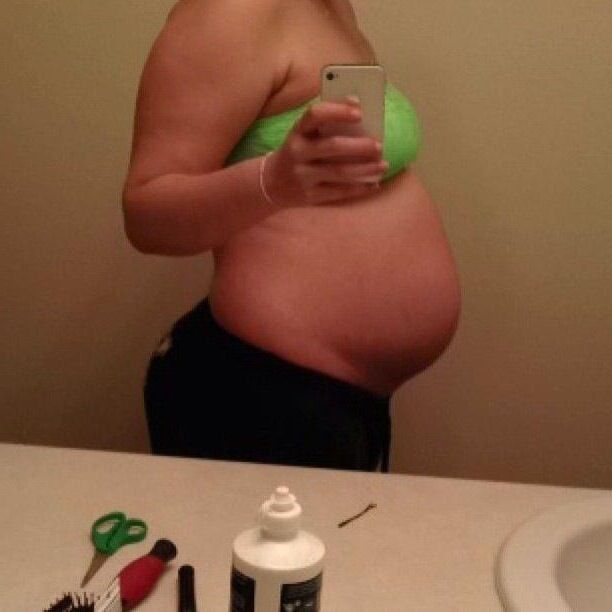 18 yo preggo with twins