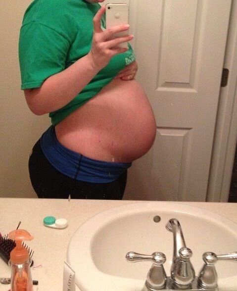 18 yo preggo with twins