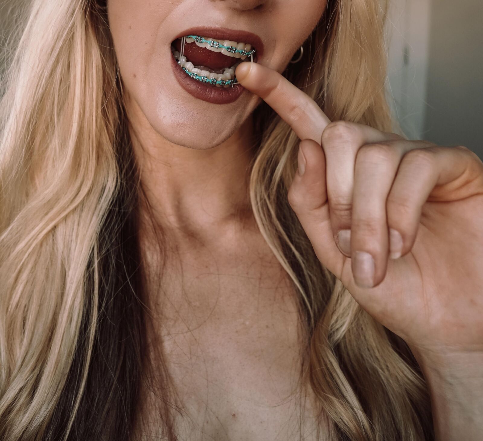 brace faced blonde slut