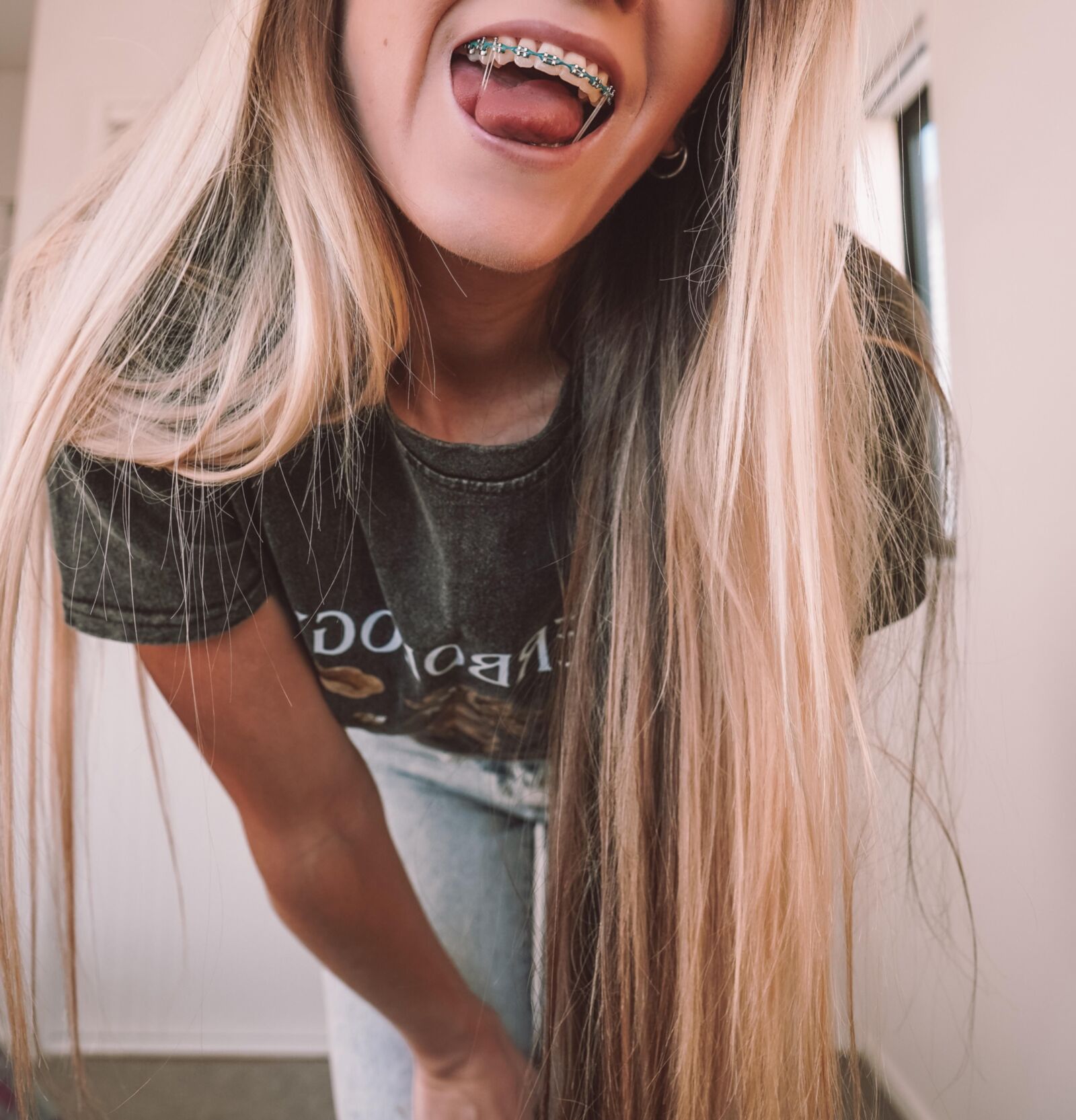 brace faced blonde slut