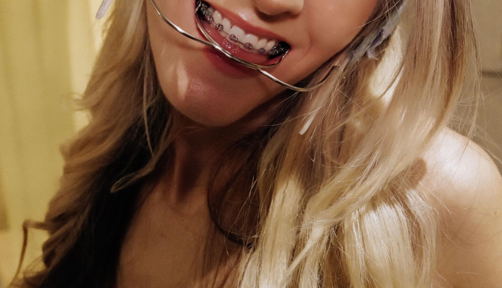 brace faced blonde slut