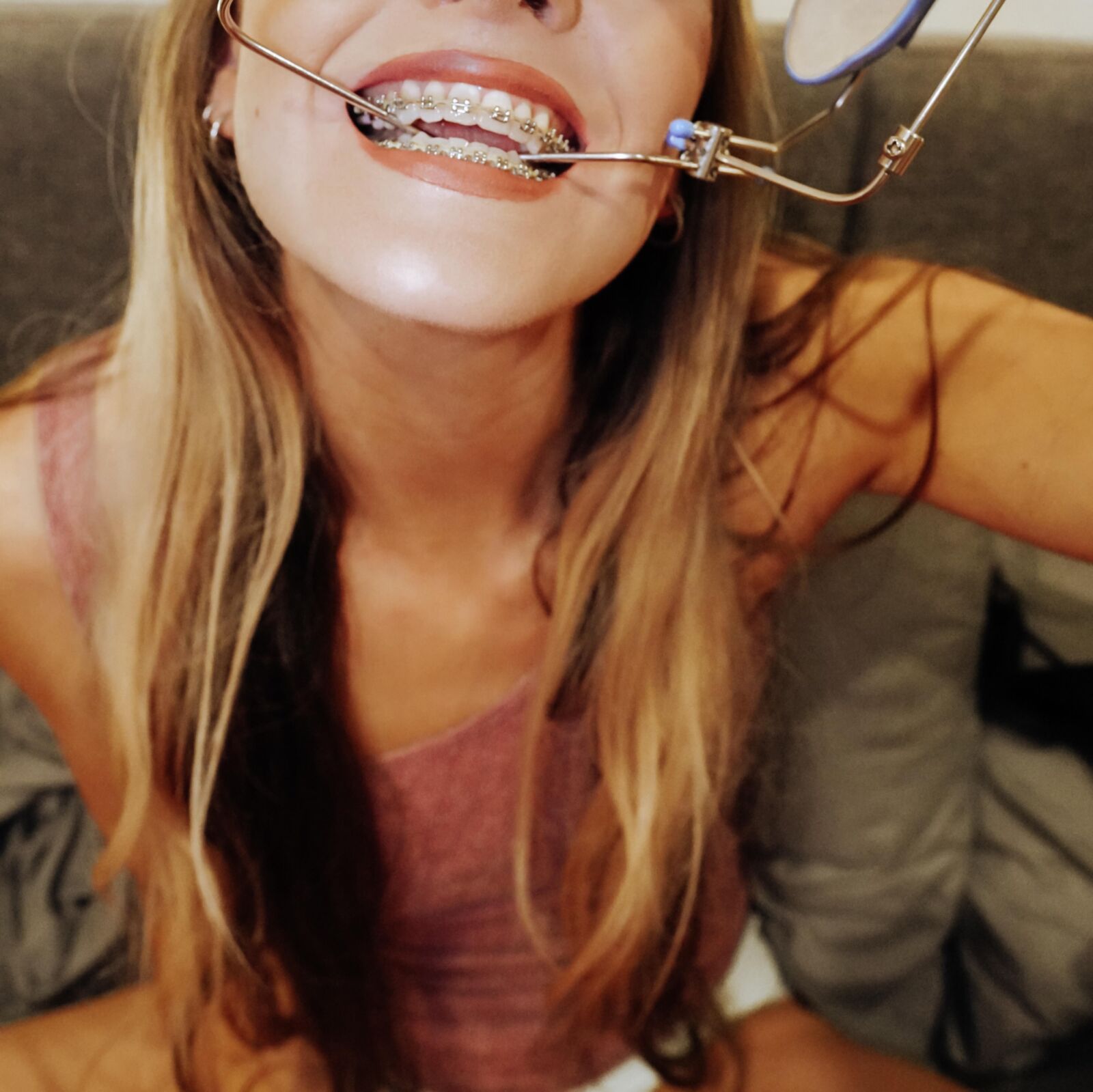 brace faced blonde slut