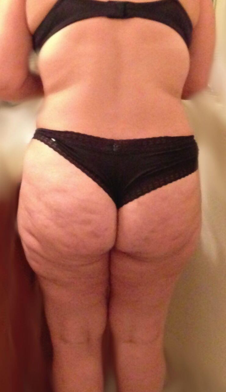 Cul cellulite