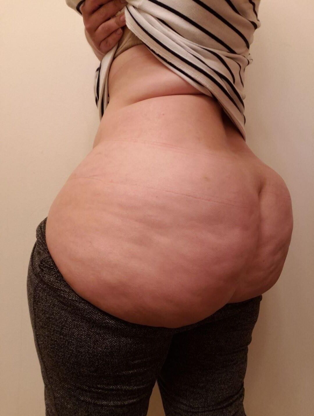 Cul cellulite