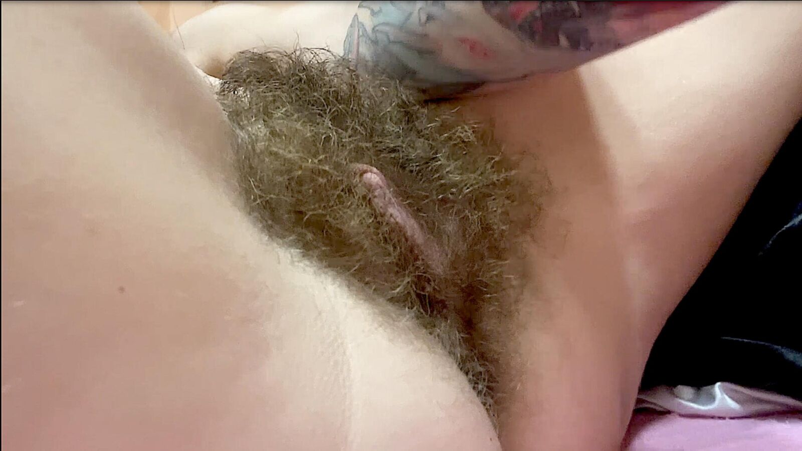Donde debería estar mucho cabello