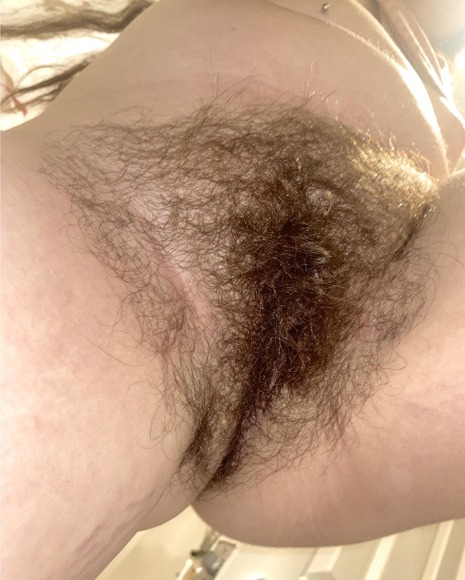 Donde debería estar mucho cabello