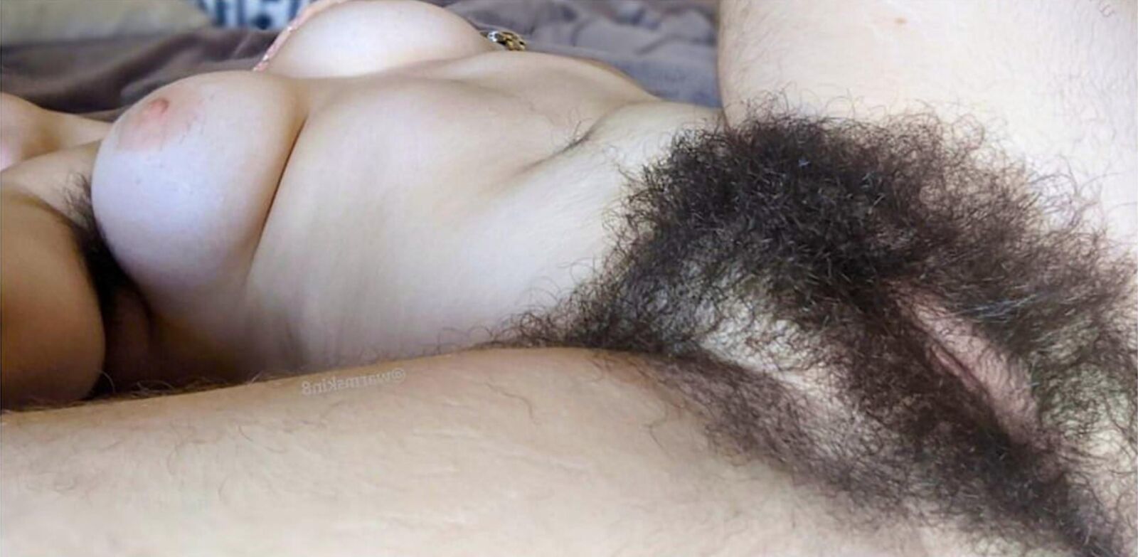Donde debería estar mucho cabello