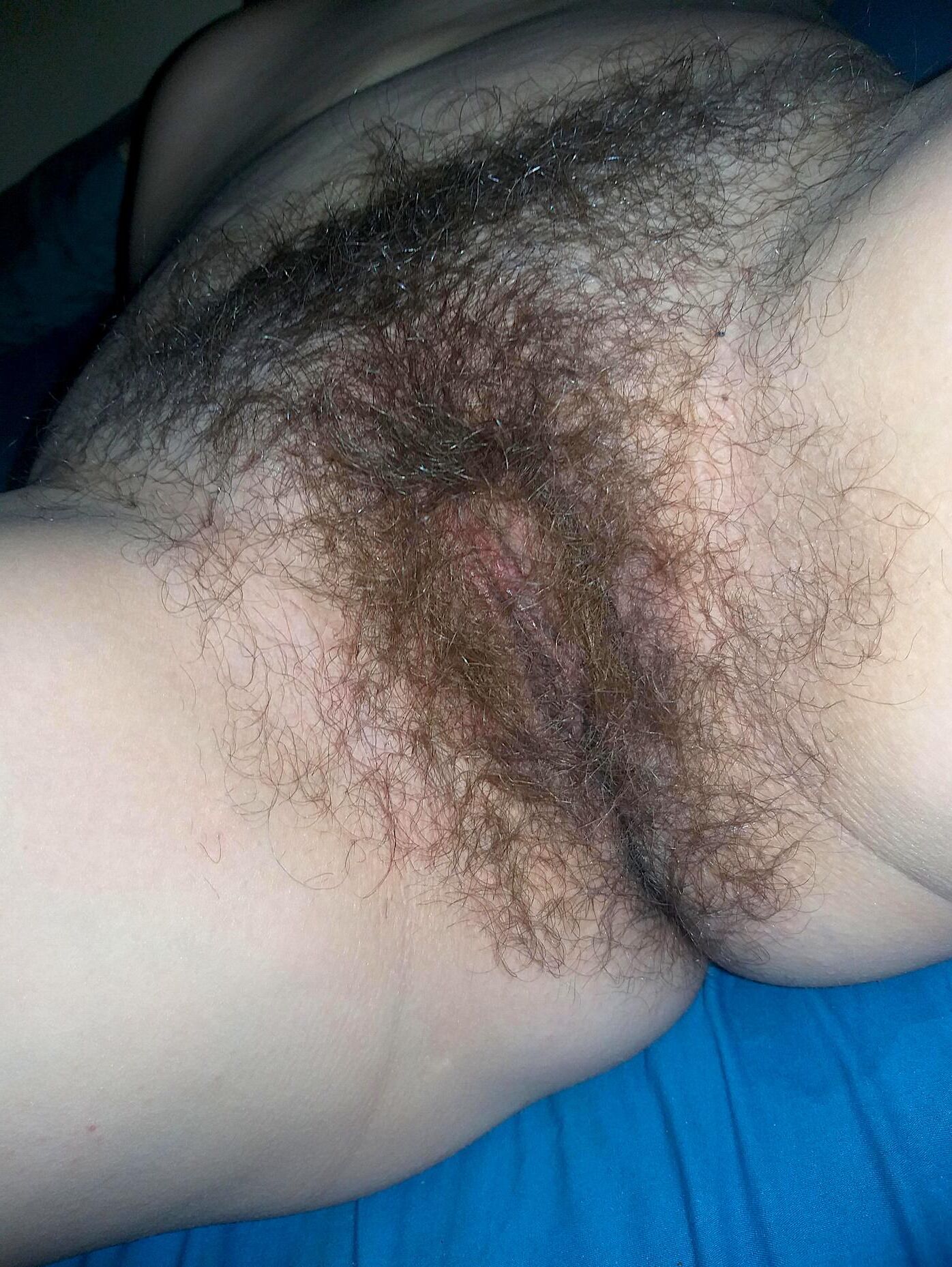 Donde debería estar mucho cabello
