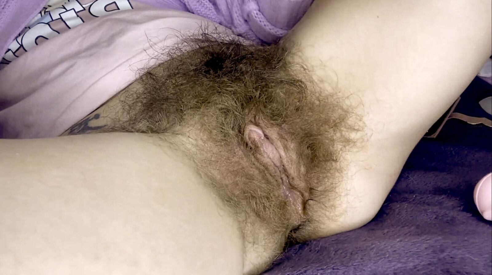 Donde debería estar mucho cabello