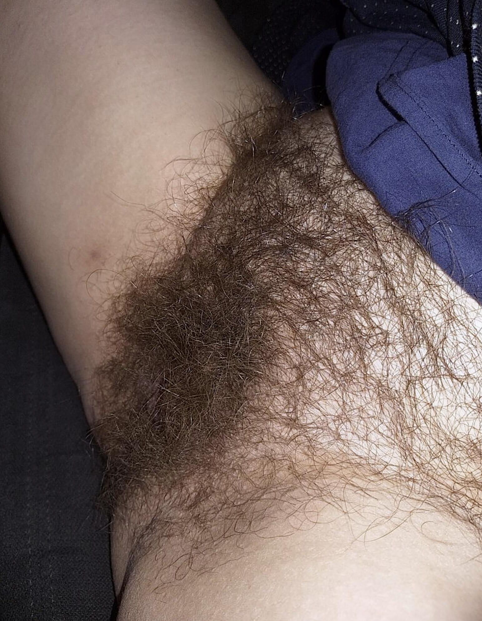 Donde debería estar mucho cabello
