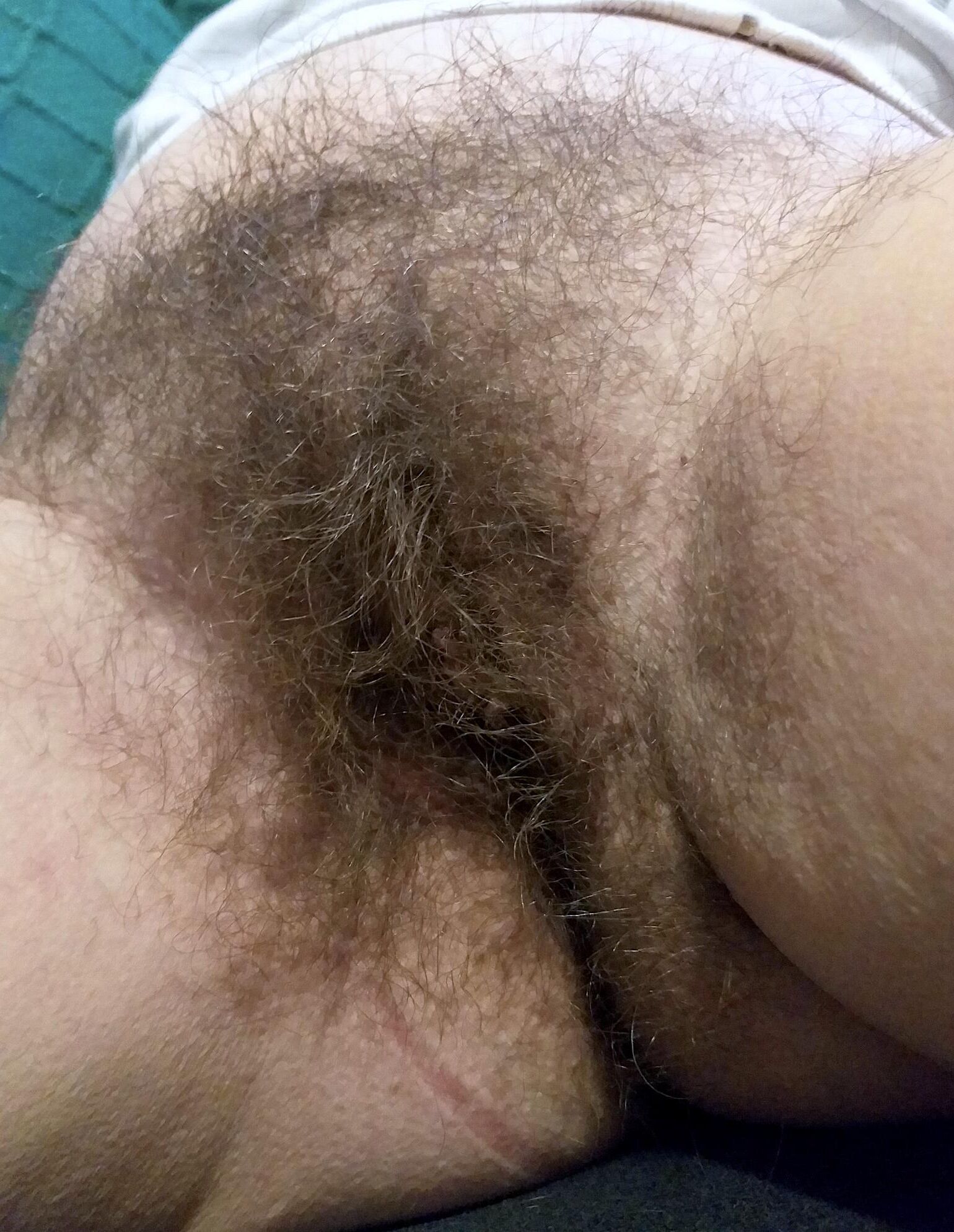 Donde debería estar mucho cabello