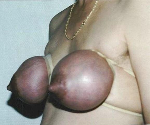 Apertado