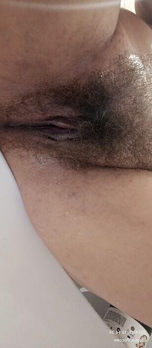 Hairy Anna
