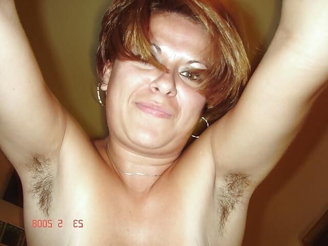 Hairy Ladies