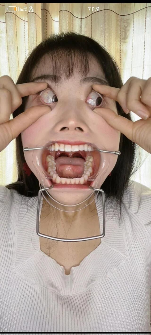 FaceFetish