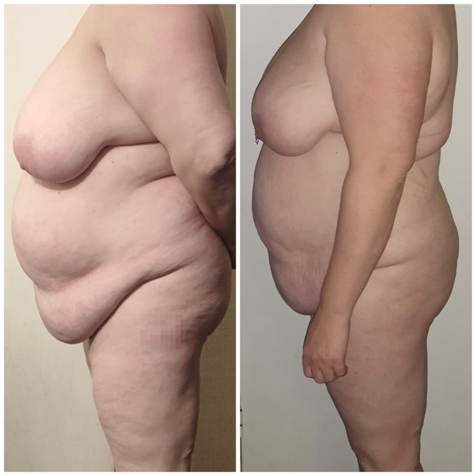 BBW Frau Comparrison