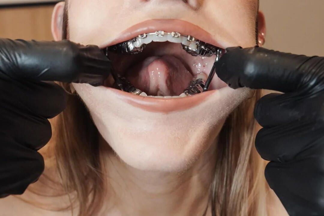 FaceFetish