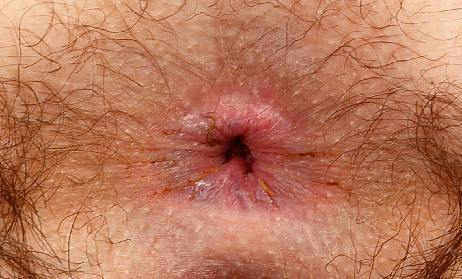 assholes with some residues around close ups