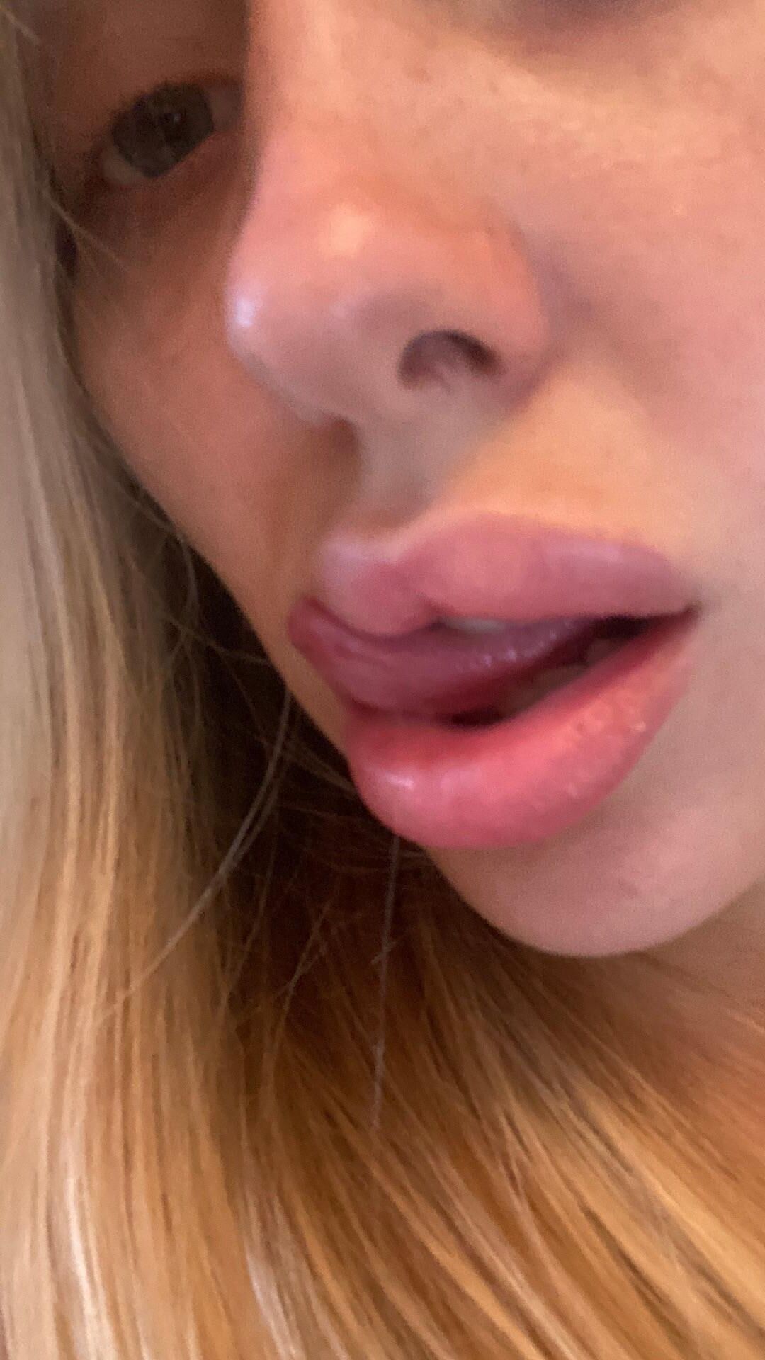 Josie loves lip filler and selling on Snap