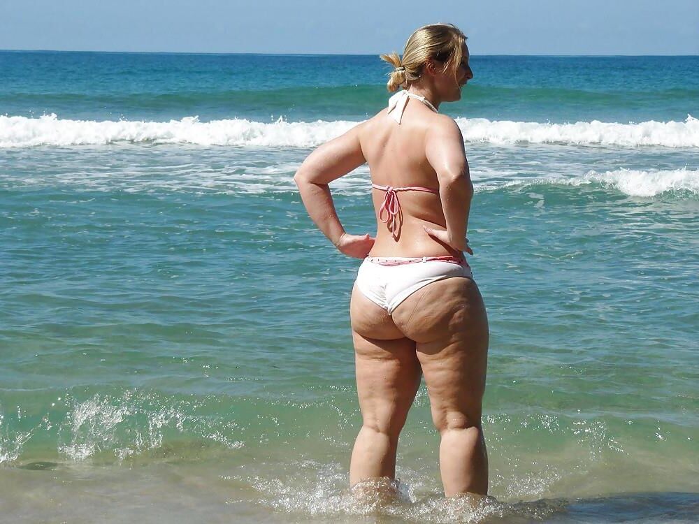 Piernas de celulitis de verano