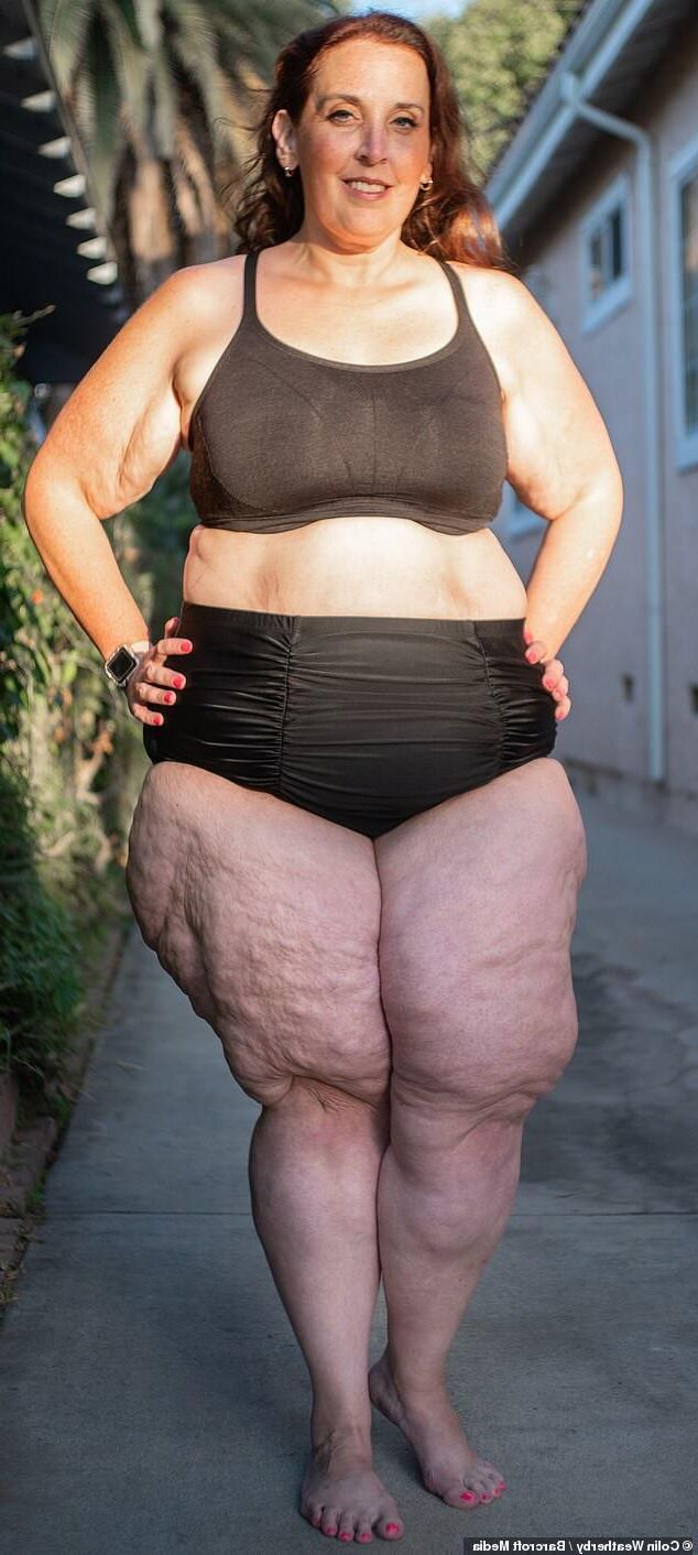 Piernas de celulitis de verano