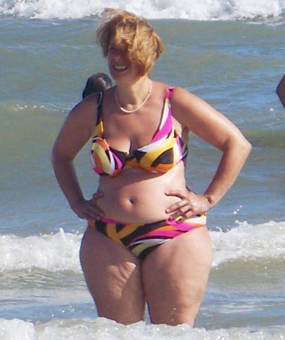 Piernas de celulitis de verano