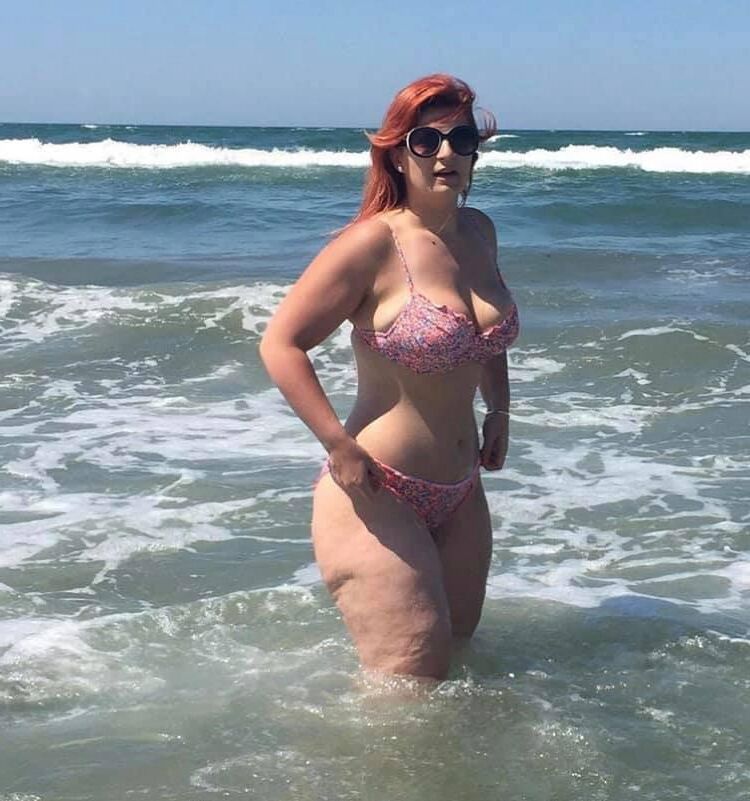 Piernas de celulitis de verano