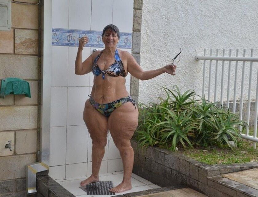 Piernas de celulitis de verano
