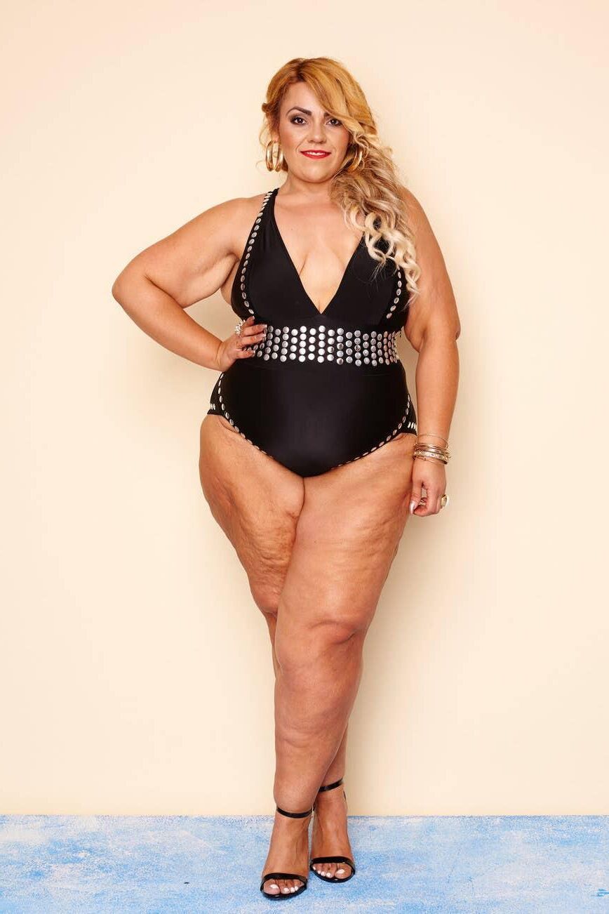 Piernas de celulitis de verano