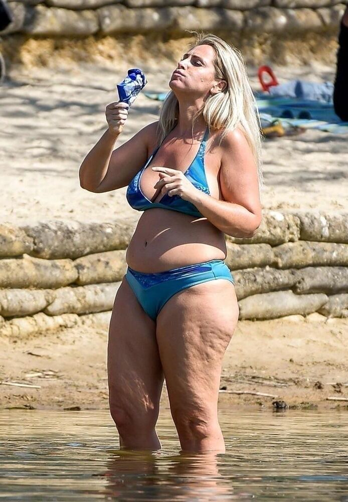 Piernas de celulitis de verano