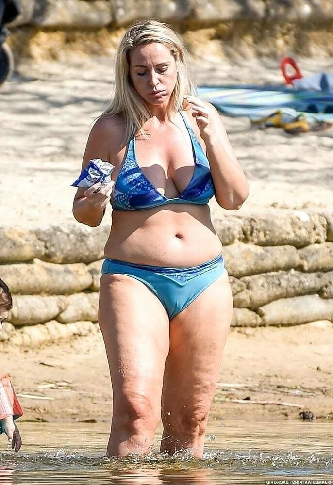 Piernas de celulitis de verano