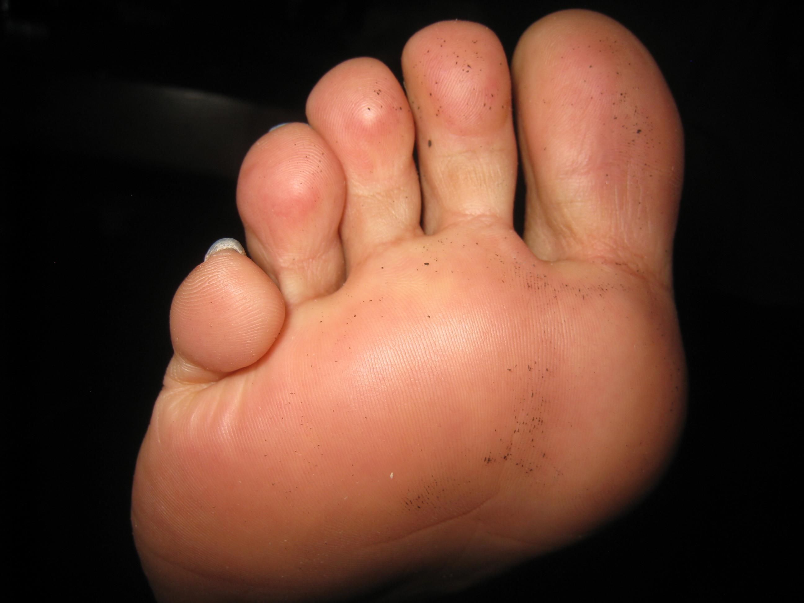 Monica's Perfect Toe's 