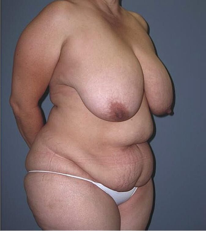 BBW Mix