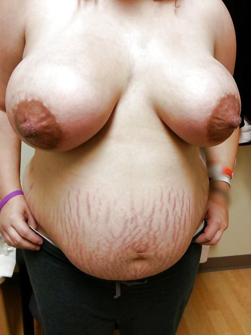 妊娠ミックス