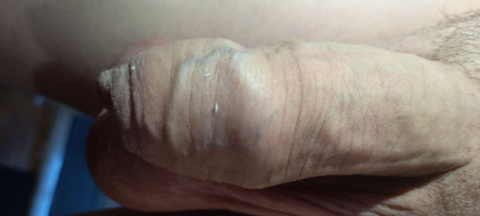 Big penis