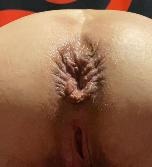 Bunda e ânus