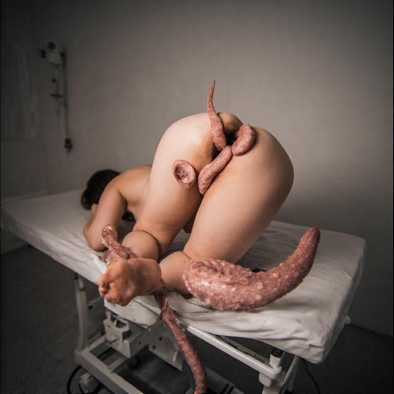 Curiosamente pacientes con el tope enfermo