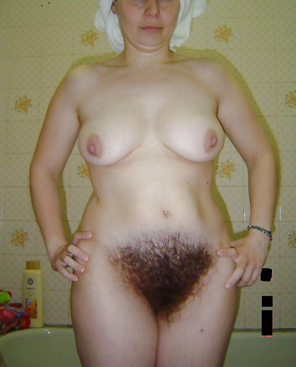 Hairy Moms 