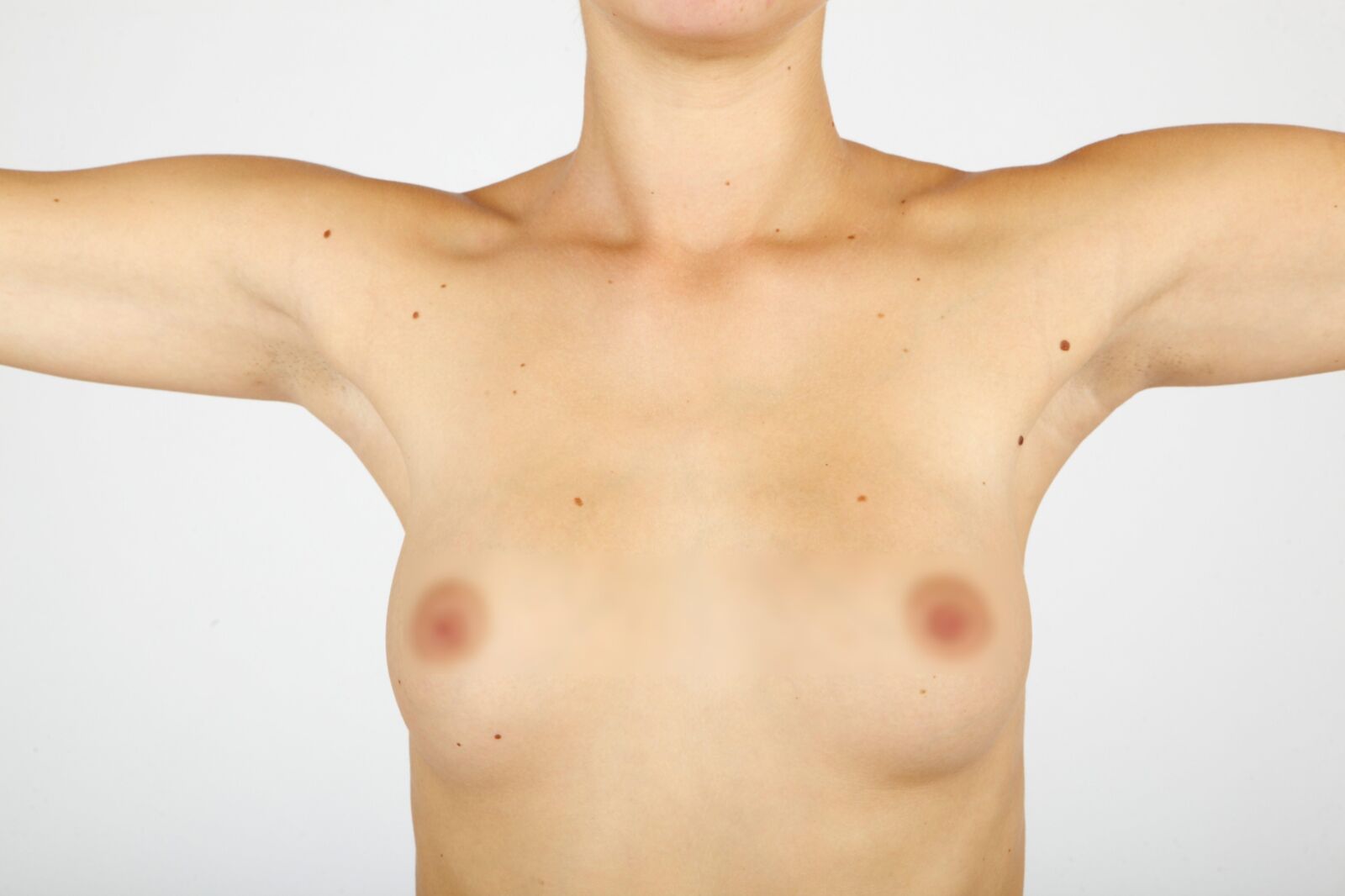 Armpit, Beta Censored 