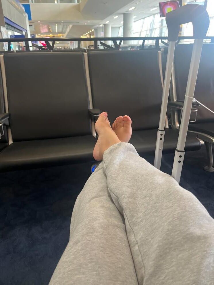  Legs, Feet, and Toes