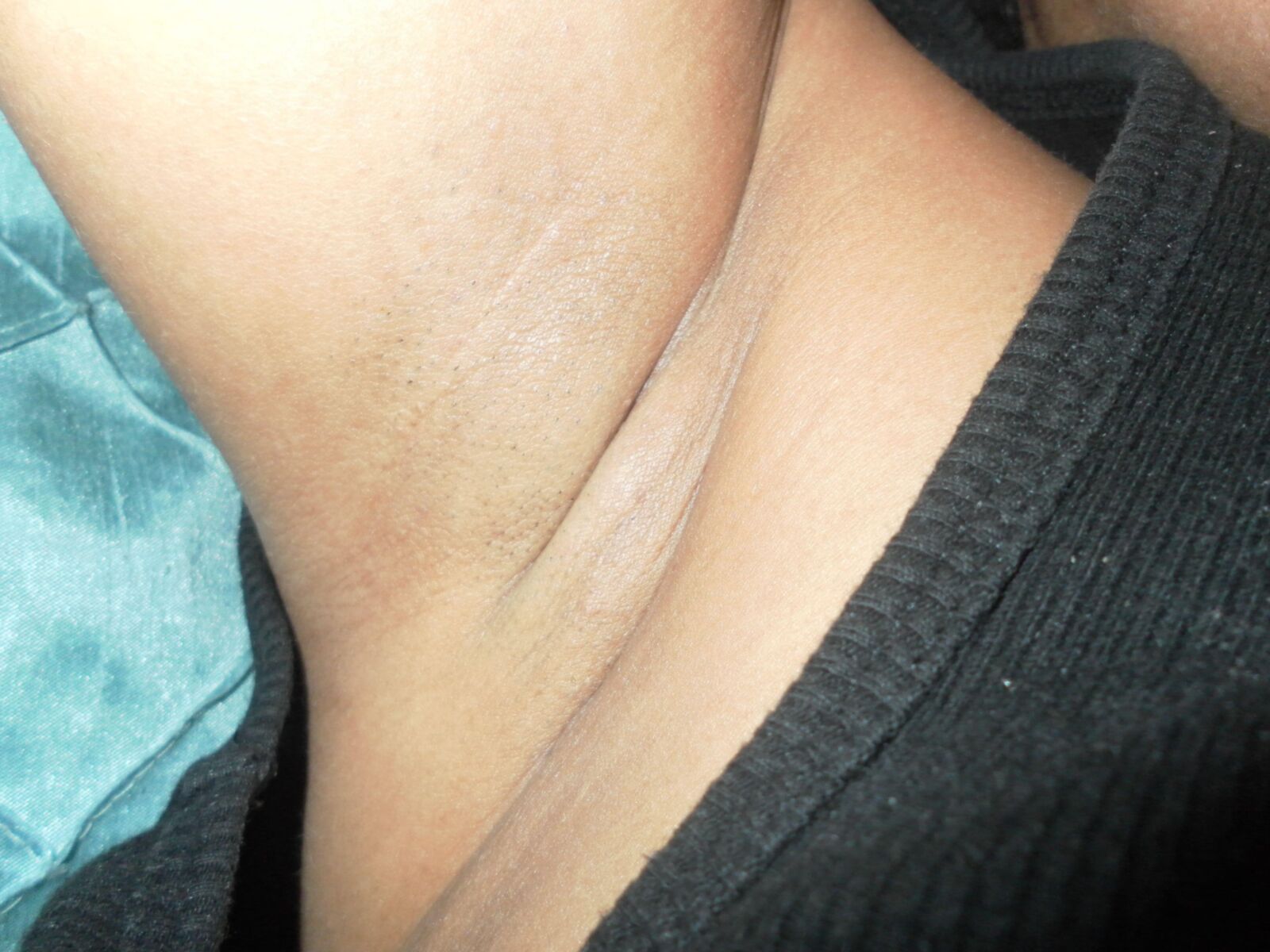 Armpit, Beta Censored 