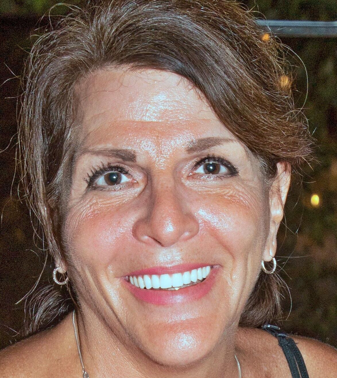 TPA de Susan